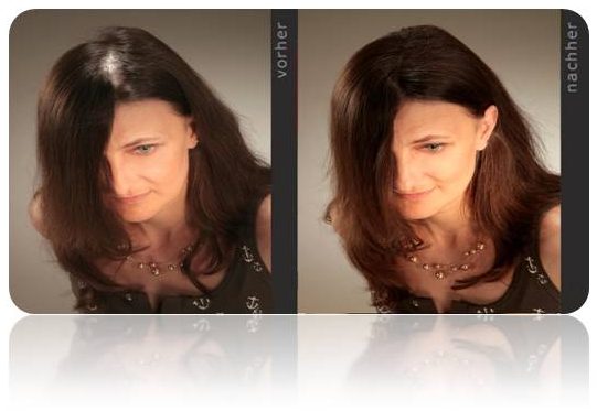 HAIRFOR2 Zahusťovač Vlasů Kompletní Balíček